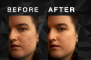 Acne removal and portrait retouch 10 - kwork.com