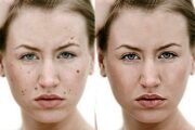 Photo processing. Face retouching 6 - kwork.com