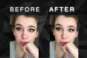 Acne removal and portrait retouch 9 - kwork.com